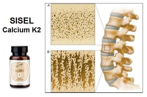 sisel-calcium_k2.jpg